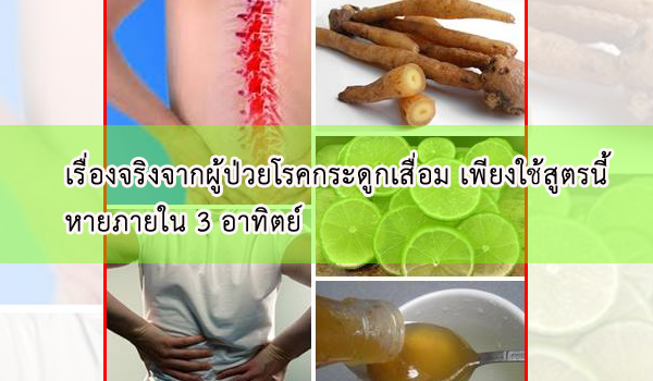เรื่องจริงจากผู้ป่วยโรคกระดูกเสื่อม เพียงใช้สูตรนี้ หายภายใน 3 อาทิตย์ ด้วยภูมิปัญญาไทย