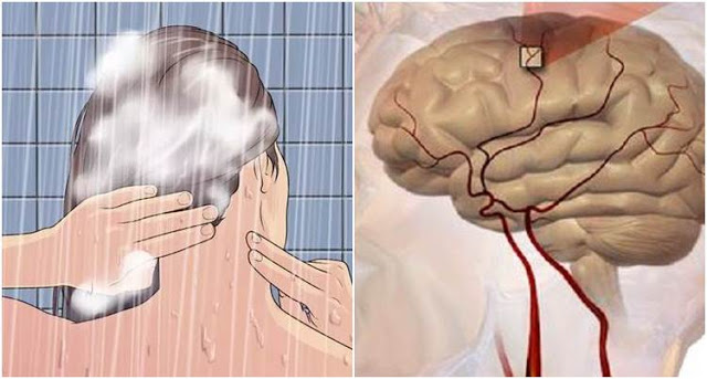 ทำไมคนเส้นเลือดในสมองแตกถึงมักเกิดในห้องน้ำ สาเหตุเพราะอาบน้ำผิดวิธีแบบนี้