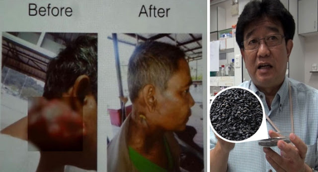 นักวิจัยไทยสุดเจ๋ง ค้นพบ สารงาดำ รักษามะเร็งครั้งแรกในโลก