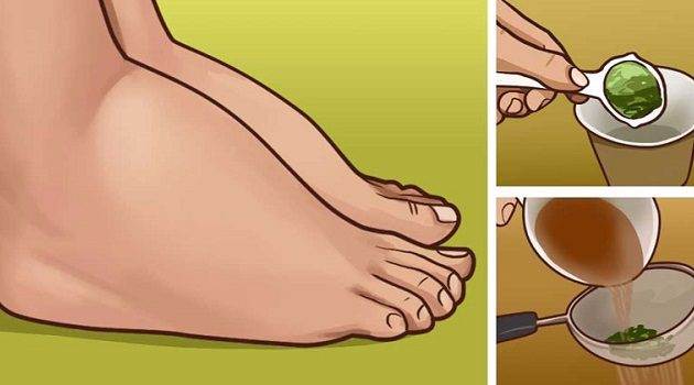 มหัศจรรย์ 3 วิธีรักษาด้วยธรรมชาติ สำหรับอาการข้อเท้าและเท้าบวม