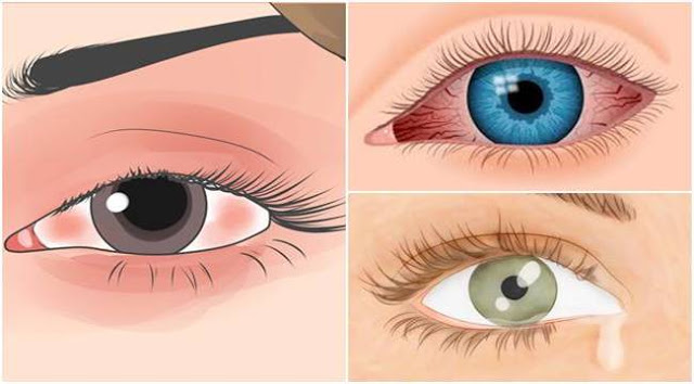 ดวงตาบอกปัญหาสุขภาพ ตรวจเช็คให้ทันเวลา อย่าปล่อยจนสายเกินไป